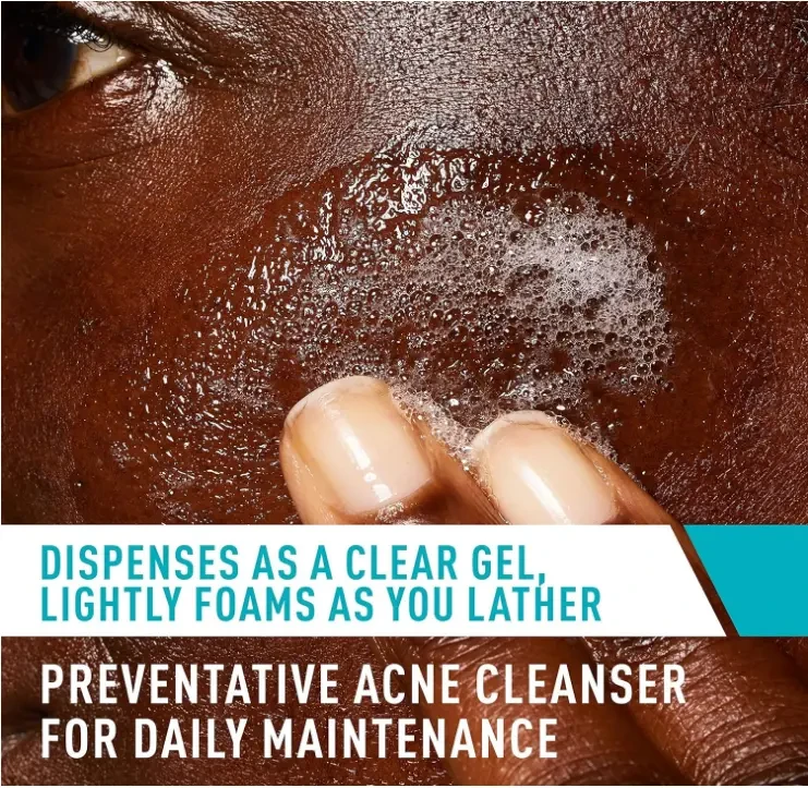 CeraVe Acne Treatment Face Wash Salicylic Acid Cleanser with Purifying Clay, Niacinamide, and Ceramides Pore Control and Blackhead Remover 8 Ounce