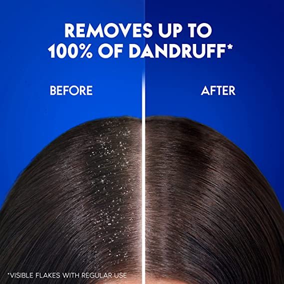 Head & Shoulders Classic Clean Anti-Dandruff Shampoo for All Hair Types, 400ml