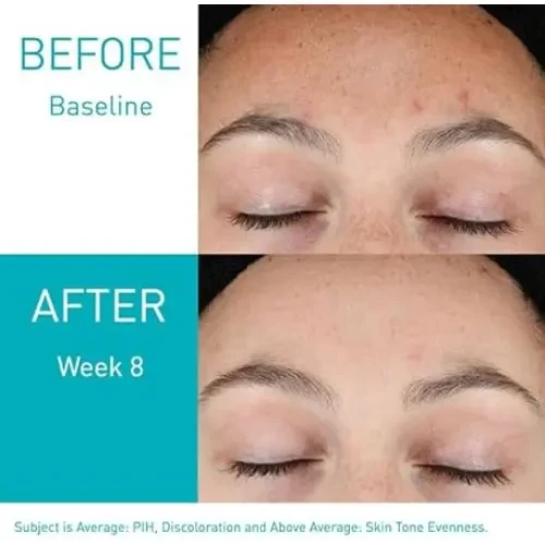 Cerave Resurfacing Retinol Serum 30 ml